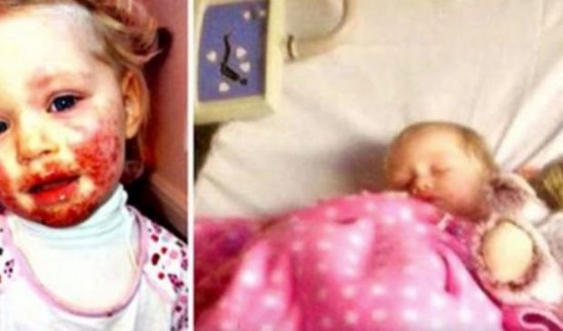 Dikkatsizliği Sonucunda Kızı Bu Hale Geldi – Anne Şimdi Diğer Ebeveynleri Bu Gizli Tehlike Hakkında Uyarıyor