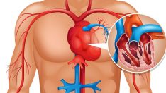 Vücudunuz Kalp Krizini 1 Ay Önceden Haber Veriyor – İşte Dikkat Etmeniz Gereken 6 Belirti