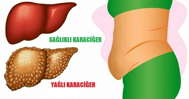 Karaciğerinizin Toksinler ile Dolu Olduğunun 6 İşareti, İşte karaciğerinizin verdiği 6 yardım sinyali!