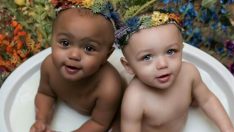 Bakın Dünyanın Farklı Ten Rengindeki İlk İkizleri Bugün Nasıl Görünüyor